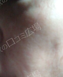 治療前の症例写真