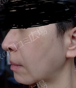 治療前の症例写真