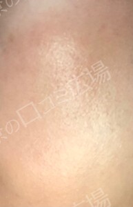 治療結果の症例写真