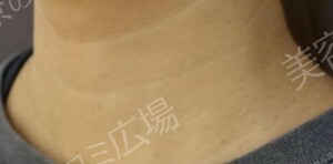 治療前の症例写真