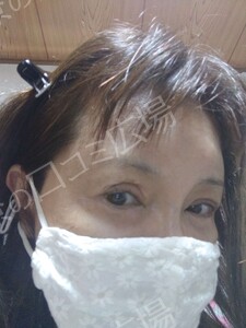 治療結果の症例写真