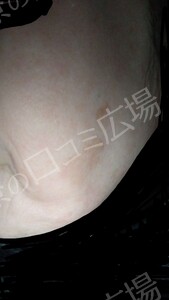 治療前の症例写真