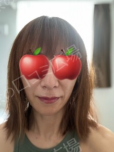 治療前の症例写真