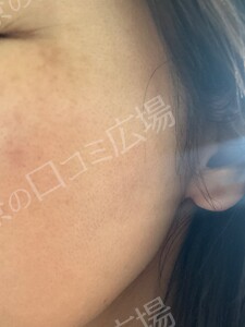 治療結果の症例写真