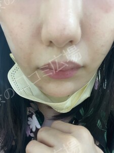 治療結果の症例写真