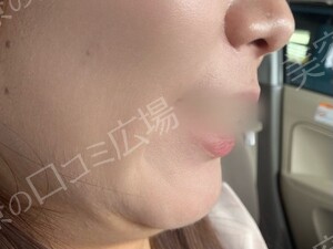 治療前の症例写真
