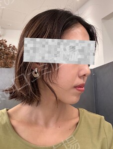 治療前の症例写真