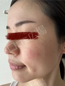 治療結果の症例写真