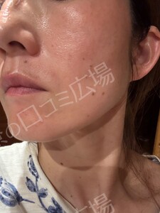 治療前の症例写真