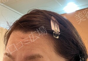 治療前の症例写真