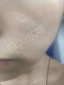 治療前の症例写真