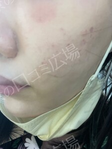 治療結果の症例写真