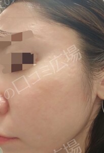 治療前の症例写真