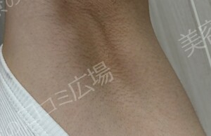 治療前の症例写真