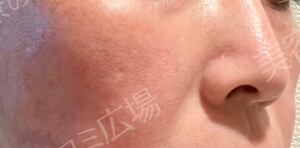 治療前の症例写真