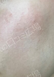 治療前の症例写真