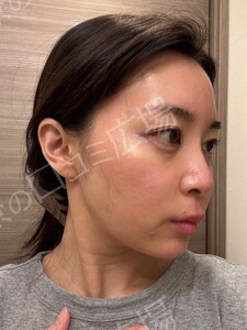 治療前の症例写真