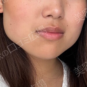 治療前の症例写真
