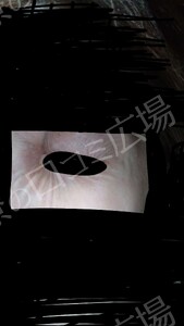 治療直後の症例写真