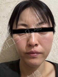 治療結果の症例写真
