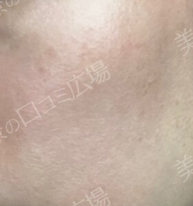 治療前の症例写真