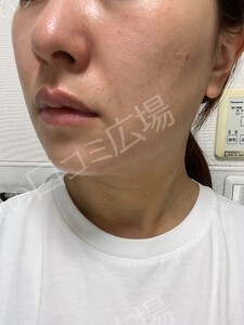 治療結果の症例写真