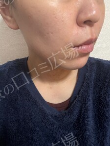 治療結果の症例写真