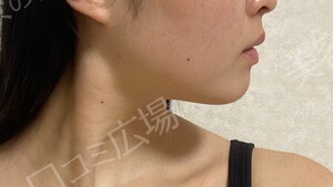 治療結果の症例写真
