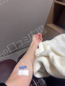 治療直後の症例写真