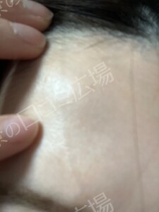 治療前の症例写真