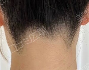 治療前の症例写真