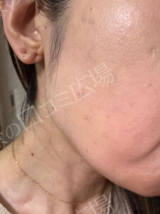 治療結果の症例写真
