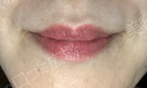 筋肉・美容クリニックの症例写真[アフター]