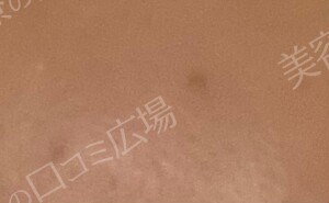 治療結果の症例写真