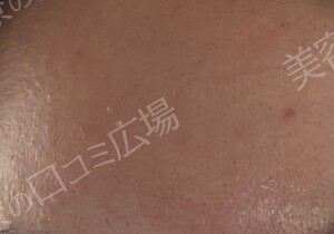 治療結果の症例写真