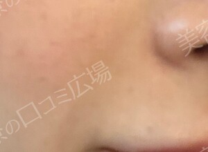 治療結果の症例写真