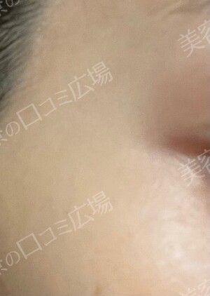 新宿中央クリニックの症例写真[アフター]