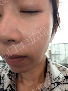 治療結果の症例写真