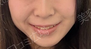 治療前の症例写真