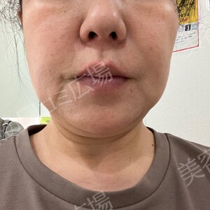 治療結果の症例写真