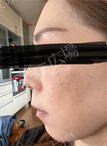 治療結果の症例写真
