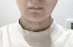 治療前の症例写真
