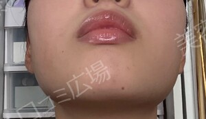 治療前の症例写真