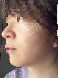 治療結果の症例写真