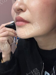 治療結果の症例写真