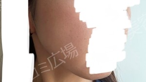 治療結果の症例写真