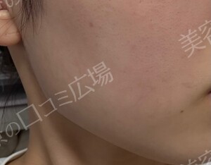 治療結果の症例写真