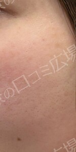 治療前の症例写真