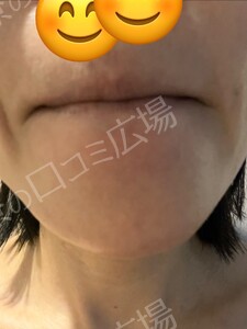 治療結果の症例写真