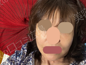 治療前の症例写真